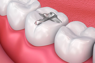 Buck Dental Health Associates | Periodontal Treatment, Dentures and Root Canals