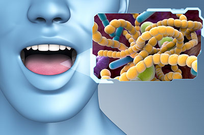 Buck Dental Health Associates | Implant Restorations, Root Canals and Night Guards