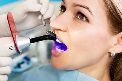 Buck Dental Health Associates | Dental Fillings, Root Canals and Implant Dentistry