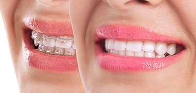 Buck Dental Health Associates | Pediatric Dentistry, Dental Cleanings and Implant Restorations