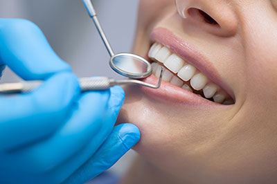 Buck Dental Health Associates | Crowns, Implant Restorations and All-on-4 reg 