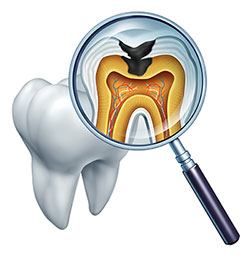 Buck Dental Health Associates | Dental Fillings, Implant Dentistry and Dental Bridges