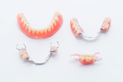 Buck Dental Health Associates | Inlays  amp  Onlays, Dental Bridges and Emergency Treatment