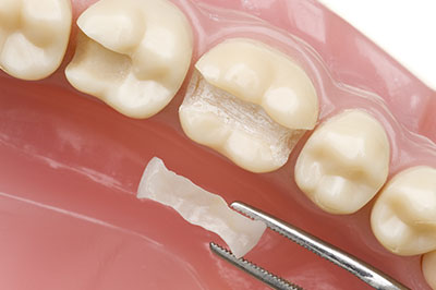 Buck Dental Health Associates | Dental Fillings, Oral Cancer Screening and Periodontal Treatment