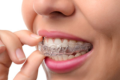 Buck Dental Health Associates | Periodontal Treatment, Root Canals and Inlays  amp  Onlays