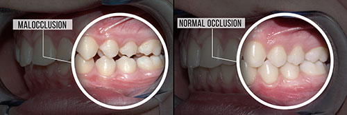 Buck Dental Health Associates | Implant Dentistry, Oral Cancer Screening and Pediatric Dentistry