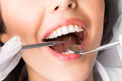 Buck Dental Health Associates | Dental Bridges, Implant Dentistry and Dental Cleanings