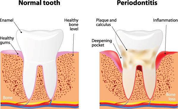 Buck Dental Health Associates | Extractions, Implant Dentistry and Periodontal Treatment
