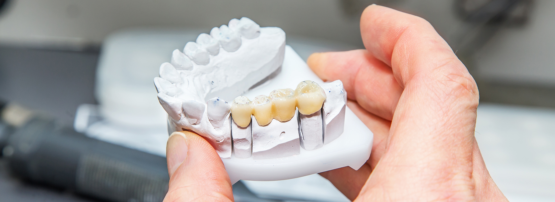 Buck Dental Health Associates | Oral Cancer Screening, Extractions and Dental Fillings