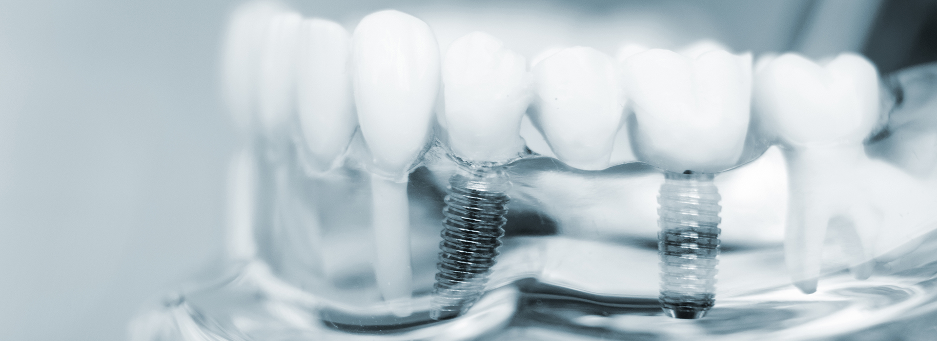 Buck Dental Health Associates | Juvederm reg , Pediatric Dentistry and All-on-4 reg 