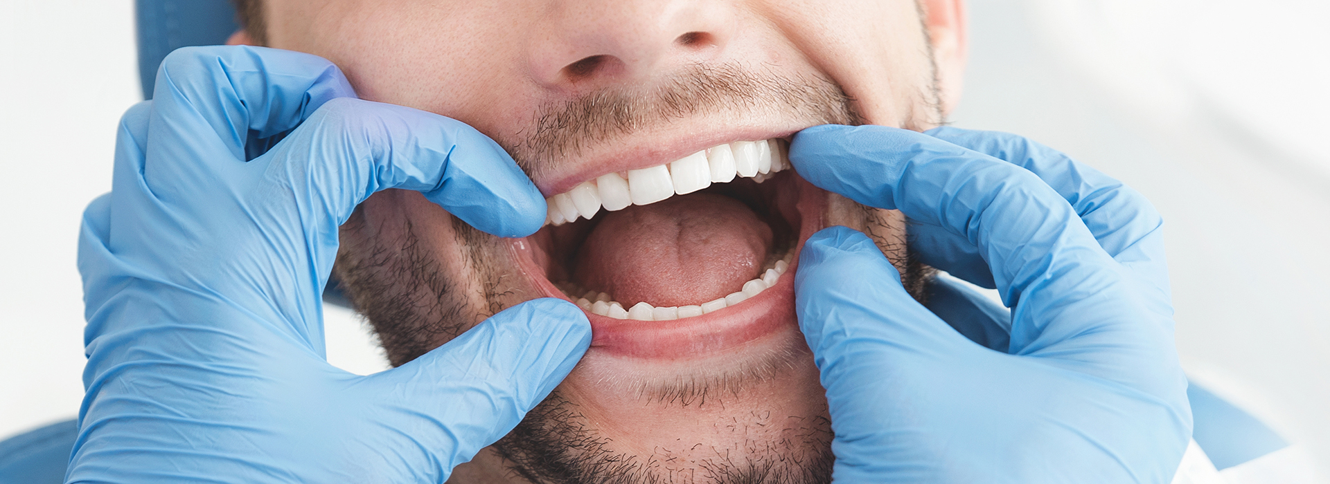 Buck Dental Health Associates | Veneers, Oral Cancer Screening and Inlays  amp  Onlays