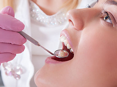 Buck Dental Health Associates | Juvederm reg , Veneers and Night Guards